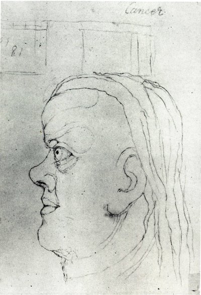 Head of Cancer by William Blake